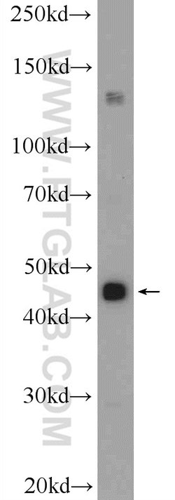 SSB Rabbit anti-Human, Mouse, Rat, Polyclonal, Proteintech:Antibodies:Primary