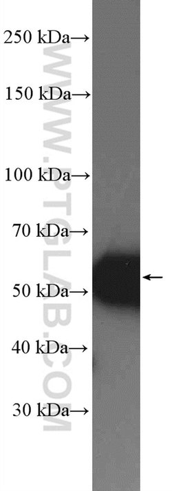 SSB Rabbit anti-Human, Mouse, Rat, Polyclonal, Proteintech:Antibodies:Primary