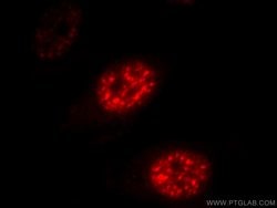 DDX39A Rabbit anti-Human, Mouse, Rat, Polyclonal, Proteintech:Antibodies:Primary