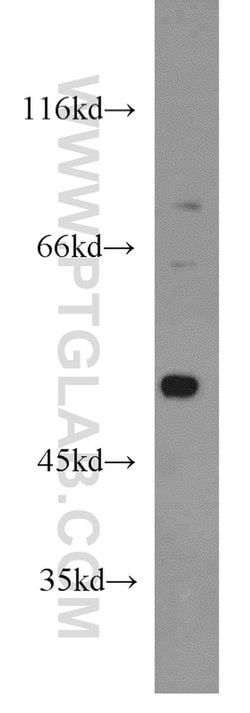 DDX39A Rabbit anti-Human, Mouse, Rat, Polyclonal, Proteintech:Antibodies:Primary