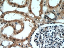DDX39A Rabbit anti-Human, Mouse, Rat, Polyclonal, Proteintech:Antibodies:Primary