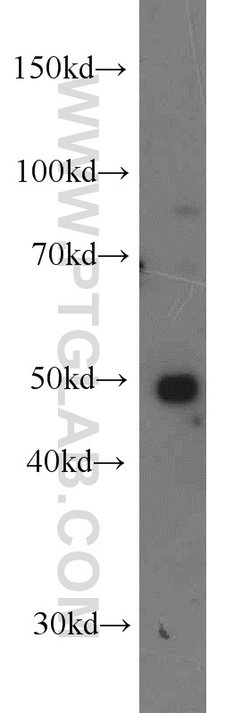 DDX39A Rabbit anti-Human, Mouse, Rat, Polyclonal, Proteintech:Antibodies:Primary