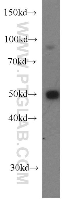DDX39A Rabbit anti-Human, Mouse, Rat, Polyclonal, Proteintech:Antibodies:Primary
