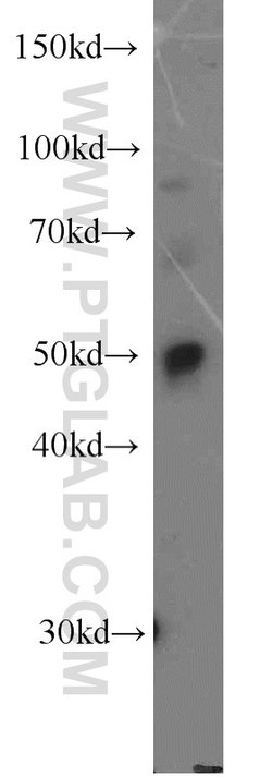 DDX39A Rabbit anti-Human, Mouse, Rat, Polyclonal, Proteintech:Antibodies:Primary