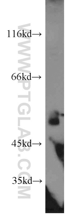 DDX39A Rabbit anti-Human, Mouse, Rat, Polyclonal, Proteintech:Antibodies:Primary