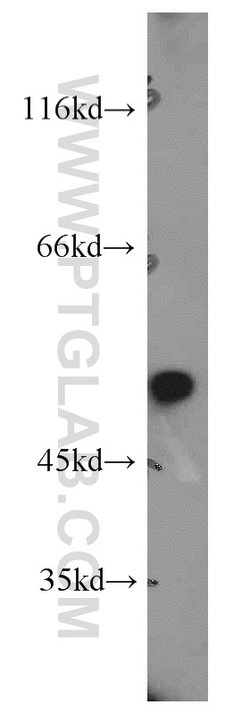 DDX39A Rabbit anti-Human, Mouse, Rat, Polyclonal, Proteintech:Antibodies:Primary