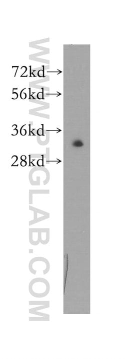Proteintech RAD1 Rabbit anti-Human, Mouse, Rat, Polyclonal, Proteintech