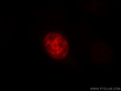 TPX2 Rabbit anti-Human, Mouse, Rat, Polyclonal, Proteintech 150 &mu;L;