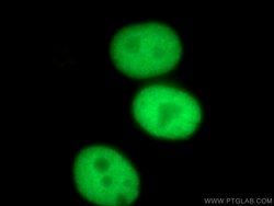TPX2 Rabbit anti-Human, Mouse, Rat, Polyclonal, Proteintech 150 &mu;L;