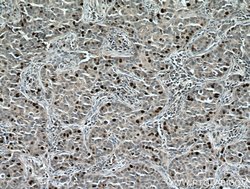 TPX2 Rabbit anti-Human, Mouse, Rat, Polyclonal, Proteintech 150 &mu;L;