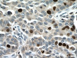 TPX2 Rabbit anti-Human, Mouse, Rat, Polyclonal, Proteintech 150 &mu;L;