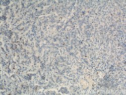 TPX2 Rabbit anti-Human, Mouse, Rat, Polyclonal, Proteintech 150 &mu;L;