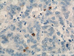 TPX2 Rabbit anti-Human, Mouse, Rat, Polyclonal, Proteintech 150 &mu;L;