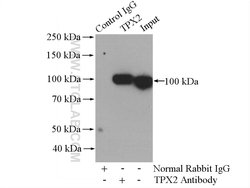 TPX2 Rabbit anti-Human, Mouse, Rat, Polyclonal, Proteintech 150 &mu;L;