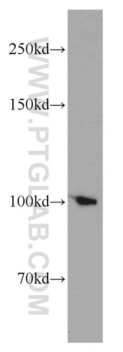 TPX2 Rabbit anti-Human, Mouse, Rat, Polyclonal, Proteintech 150 &mu;L;