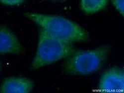 SPRR3 Rabbit anti-Human, Polyclonal, Proteintech:Antibodies:Primary Antibodies