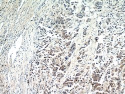 SPRR3 Rabbit anti-Human, Polyclonal, Proteintech:Antibodies:Primary Antibodies