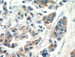 SPRR3 Rabbit anti-Human, Polyclonal, Proteintech:Antibodies:Primary Antibodies