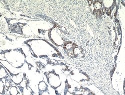 SPRR3 Rabbit anti-Human, Polyclonal, Proteintech:Antibodies:Primary Antibodies