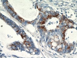 SPRR3 Rabbit anti-Human, Polyclonal, Proteintech:Antibodies:Primary Antibodies