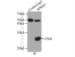 SPRR3 Rabbit anti-Human, Polyclonal, Proteintech:Antibodies:Primary Antibodies