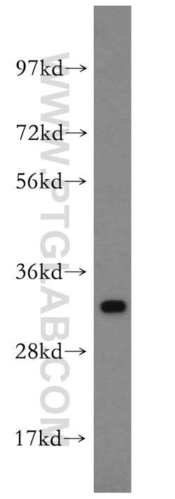 SPRR3 Rabbit anti-Human, Polyclonal, Proteintech:Antibodies:Primary Antibodies