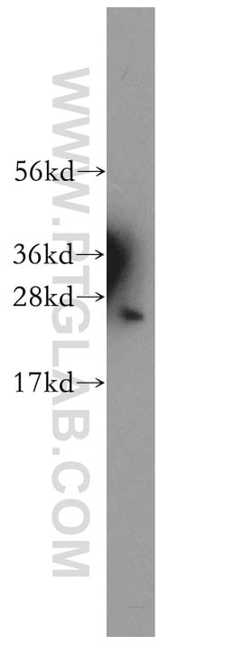 PSMB1 Rabbit anti-Human, Mouse, Rat, Polyclonal, Proteintech:Antibodies:Primary
