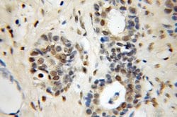 NFIA Rabbit anti-Human, Mouse, Rat, Polyclonal, Proteintech 150 &mu;L;