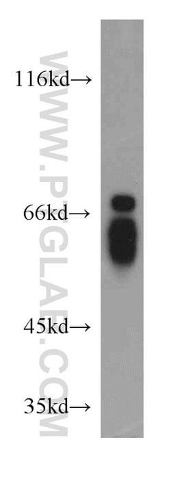NFIA Rabbit anti-Human, Mouse, Rat, Polyclonal, Proteintech 150 &mu;L;