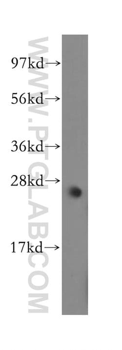 MYF6 Rabbit anti-Human, Mouse, Rat, Polyclonal, Proteintech 150 &mu;L;