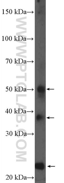 HFE2 Rabbit anti-Human, Mouse, Rat, Polyclonal, Proteintech:Antibodies:Primary