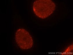 HNRNPC Rabbit anti-Human, Mouse, Rat, Polyclonal, Proteintech 150 &mu;L;
