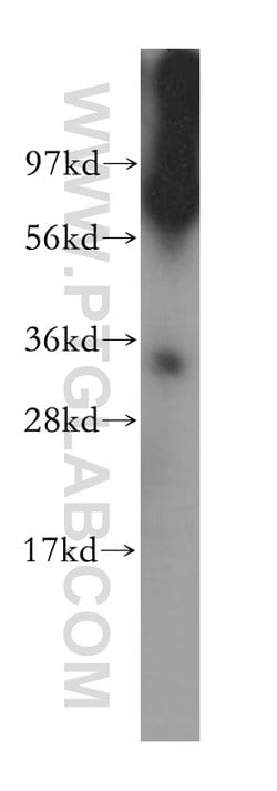 HNRNPC Rabbit anti-Human, Mouse, Rat, Polyclonal, Proteintech 150 &mu;L;