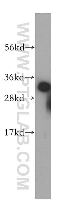 HNRNPC Rabbit anti-Human, Mouse, Rat, Polyclonal, Proteintech 150 &mu;L;