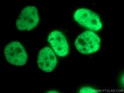 HNRNPC Rabbit anti-Human, Mouse, Rat, Polyclonal, Proteintech 150 &mu;L;