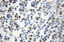 HNRNPC Rabbit anti-Human, Mouse, Rat, Polyclonal, Proteintech 150 &mu;L;