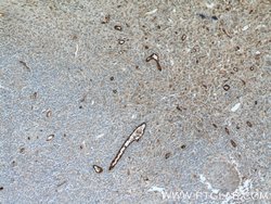 VWF/VWFpp Rabbit anti-Human, Mouse, Rat, Polyclonal, Proteintech 150 &mu;L;