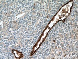 VWF/VWFpp Rabbit anti-Human, Mouse, Rat, Polyclonal, Proteintech 150 &mu;L;