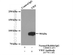 VWF/VWFpp Rabbit anti-Human, Mouse, Rat, Polyclonal, Proteintech 20 &mu;L; Unconjugated 