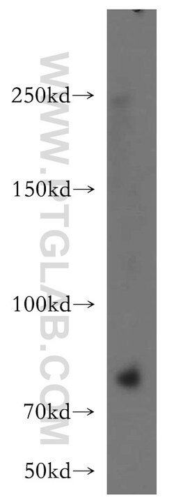 VWF/VWFpp Rabbit anti-Human, Mouse, Rat, Polyclonal, Proteintech 20 &mu;L; Unconjugated 