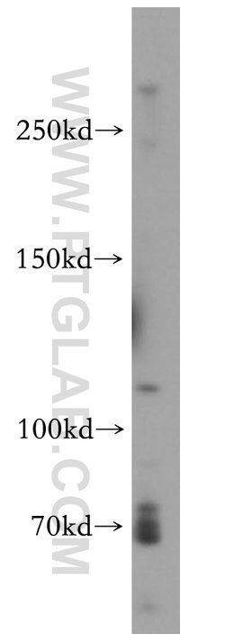 VWF/VWFpp Rabbit anti-Human, Mouse, Rat, Polyclonal, Proteintech 20 &mu;L; Unconjugated 