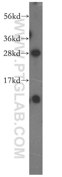 NIPSNAP3B Rabbit anti-Human, Polyclonal, Proteintech 150 &mu;L; Unconjugated:Antibodies,