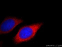 TREM1 Rabbit anti-Human, Mouse, Polyclonal, Proteintech:Antibodies:Primary