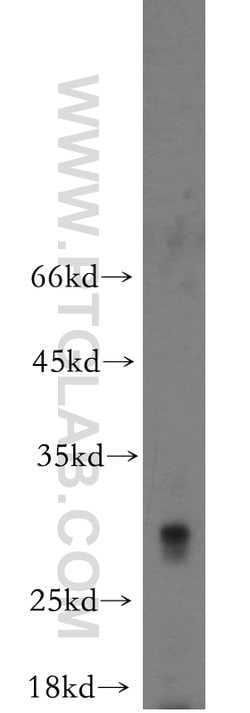 TREM1 Rabbit anti-Human, Mouse, Polyclonal, Proteintech:Antibodies:Primary