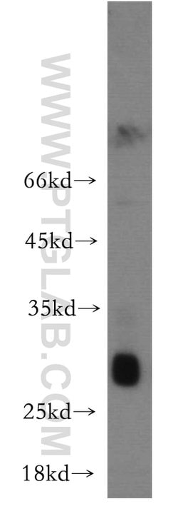 TREM1 Rabbit anti-Human, Mouse, Polyclonal, Proteintech:Antibodies:Primary