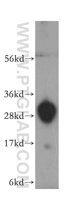 TREM1 Rabbit anti-Human, Mouse, Polyclonal, Proteintech:Antibodies:Primary