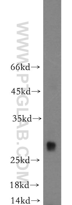 TREM1 Rabbit anti-Human, Mouse, Polyclonal, Proteintech:Antibodies:Primary