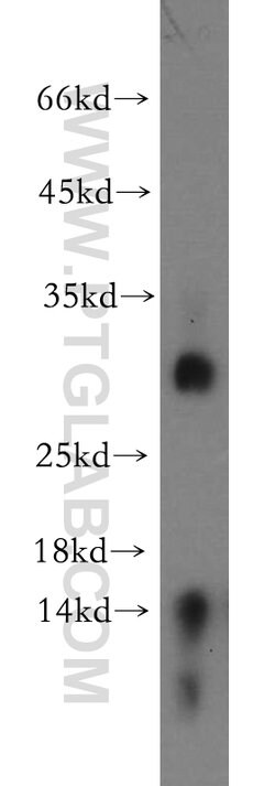 TREM1 Rabbit anti-Human, Mouse, Polyclonal, Proteintech:Antibodies:Primary