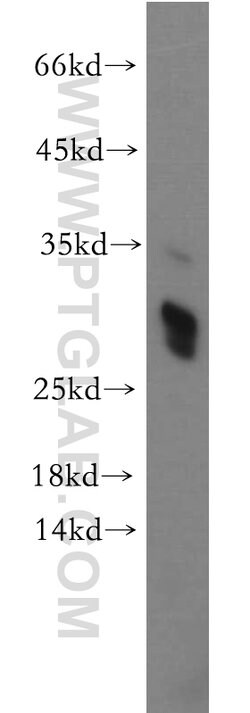 TREM1 Rabbit anti-Human, Mouse, Polyclonal, Proteintech:Antibodies:Primary