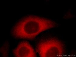 TPD52L2 Rabbit anti-Human, Mouse, Rat, Polyclonal, Proteintech 150 &mu;L;